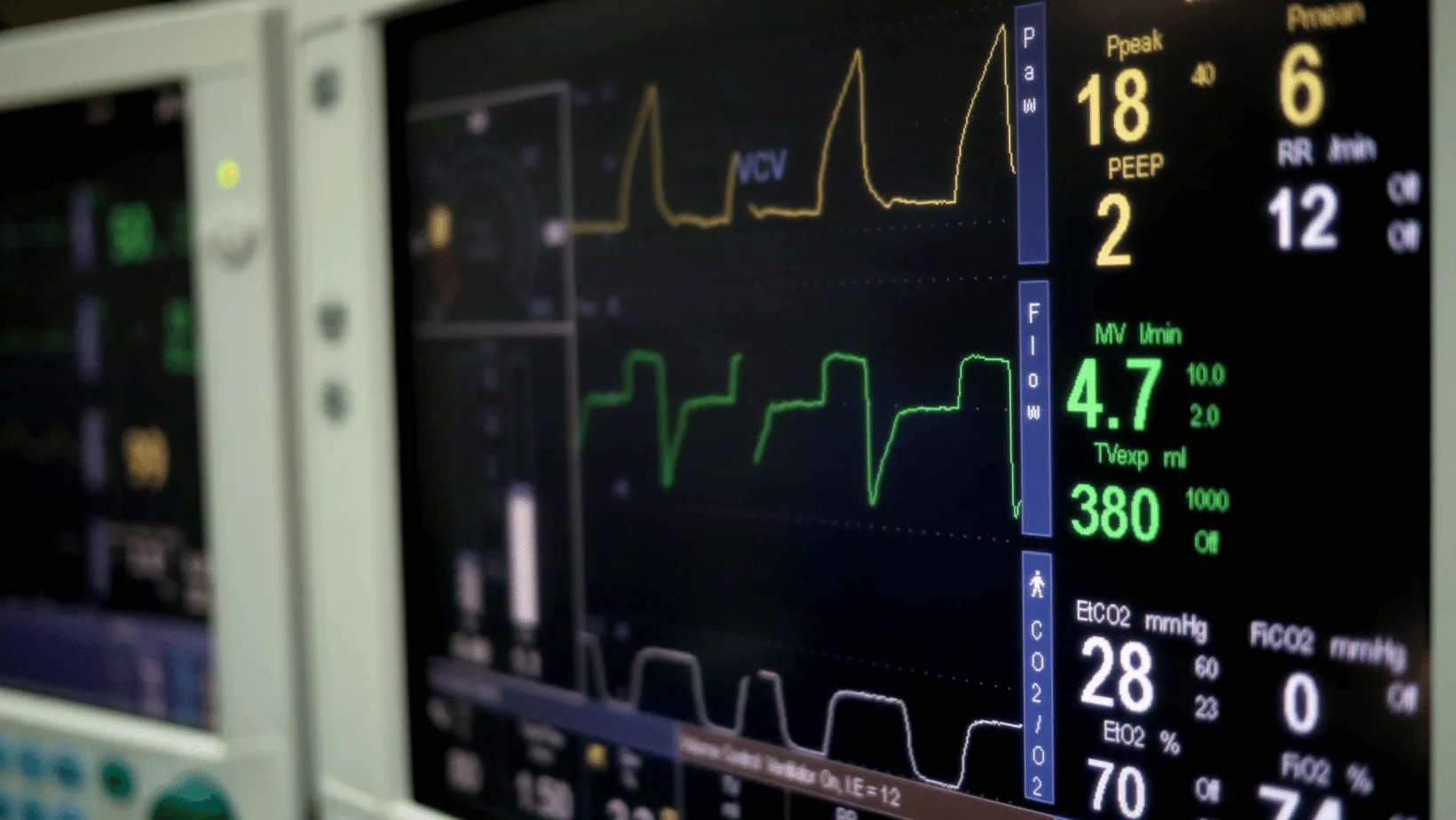 Close-up of a medical ventilator's monitor displaying various critical respiratory parameters and waveforms, such as pressure, flow, and carbon dioxide levels.